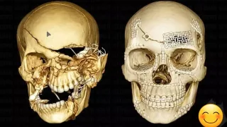 द्वारका के अस्पताल में बड़ा चमत्कार: डॉक्टरों ने 27 साल के युवक को दी नई जिंदगी